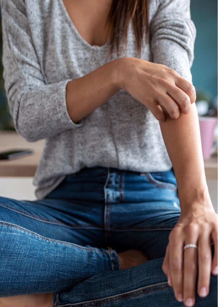 A woman with psoriasis scratches her itchy skin.